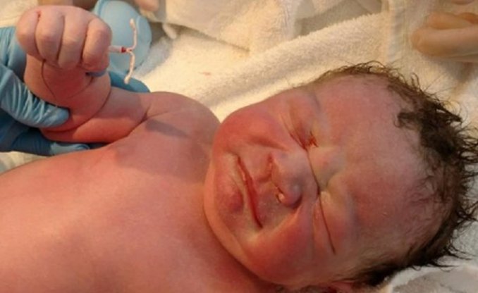 Un bebé nació agarrando en su mano el DIU de su mamá